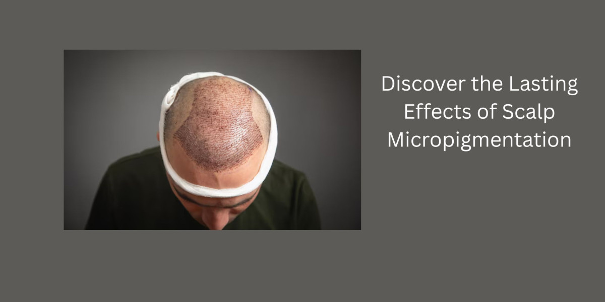 Discover the Lasting Effects of Scalp Micropigmentation