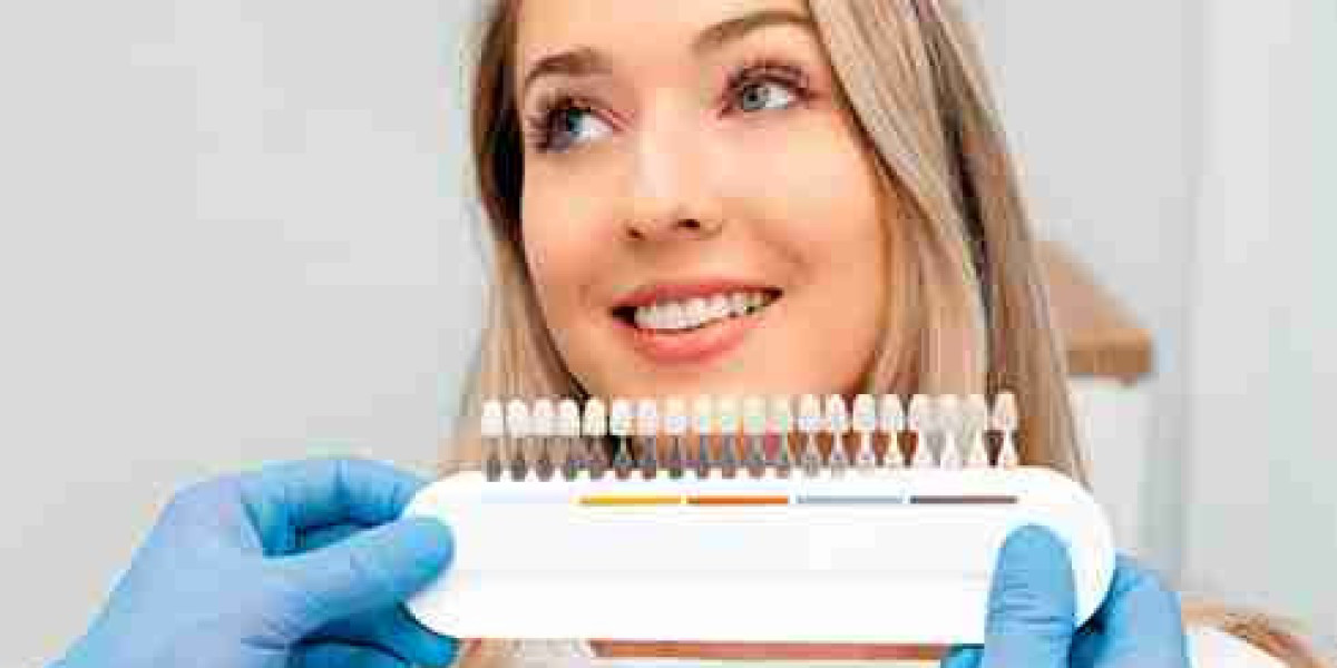 The Connection Between Diet and Dental Health in Southbourne