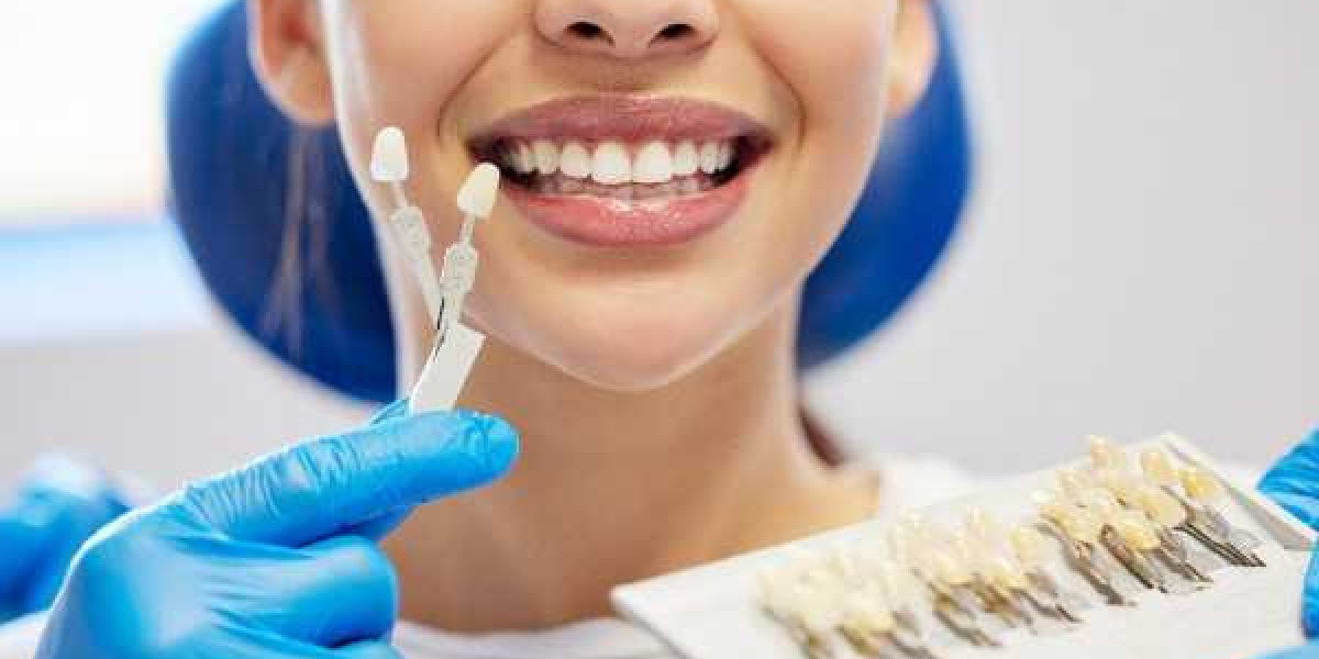 How Well Does Charcoal Work for Whitening Teeth?